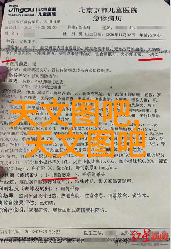 分离机的秘密结构与功能之谜